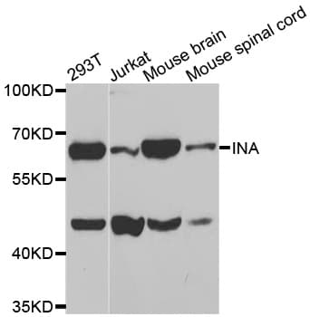 Polyclonal Rabbit anti-Human INA / Alpha Internexin Antibody (IHC, WB)