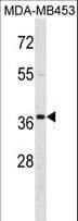 Polyclonal Rabbit anti-Human GAX / MEOX2 Antibody (aa164-192, IF, WB)