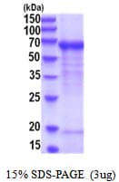 Human DBH/Dopamine Beta Hydroxylase Protein (Recombinant His)