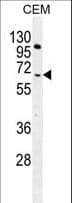 IHC-plus™ Polyclonal Rabbit anti-Human COL8A2 / Collagen VIII Antibody (aa571-599, IHC, IF, WB)