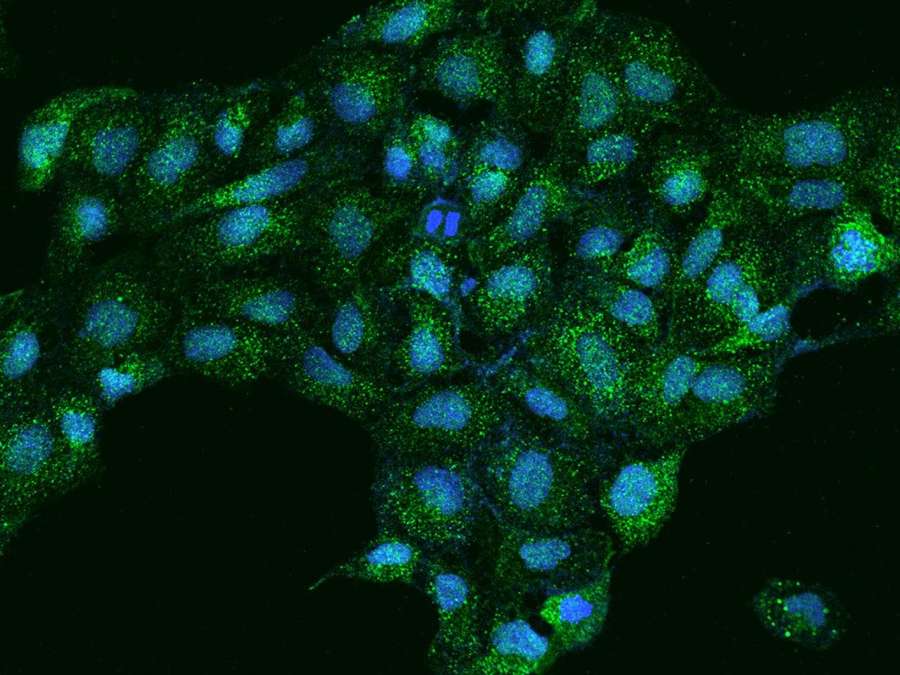 EPS8L3 Antibody