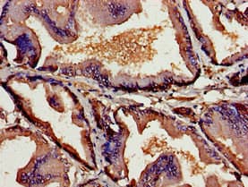 TSLP Antibody