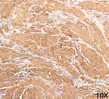 Monoclonal Mouse anti-Human Actin Antibody (clone HHF35, Azide-free,BSA-free, IHC, IF, WB)