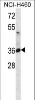 ATP1B3 Antibody (aa241-270)