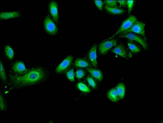 TRIM4 / RNF87 Antibody