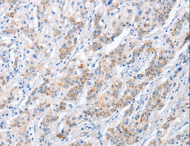 PAPSS 1 Antibody