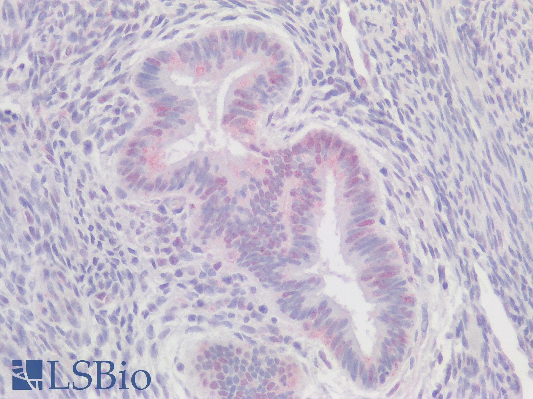 IHC-plus™ Polyclonal Rabbit anti-Human DKK1 Antibody (Internal Region, IHC, WB)