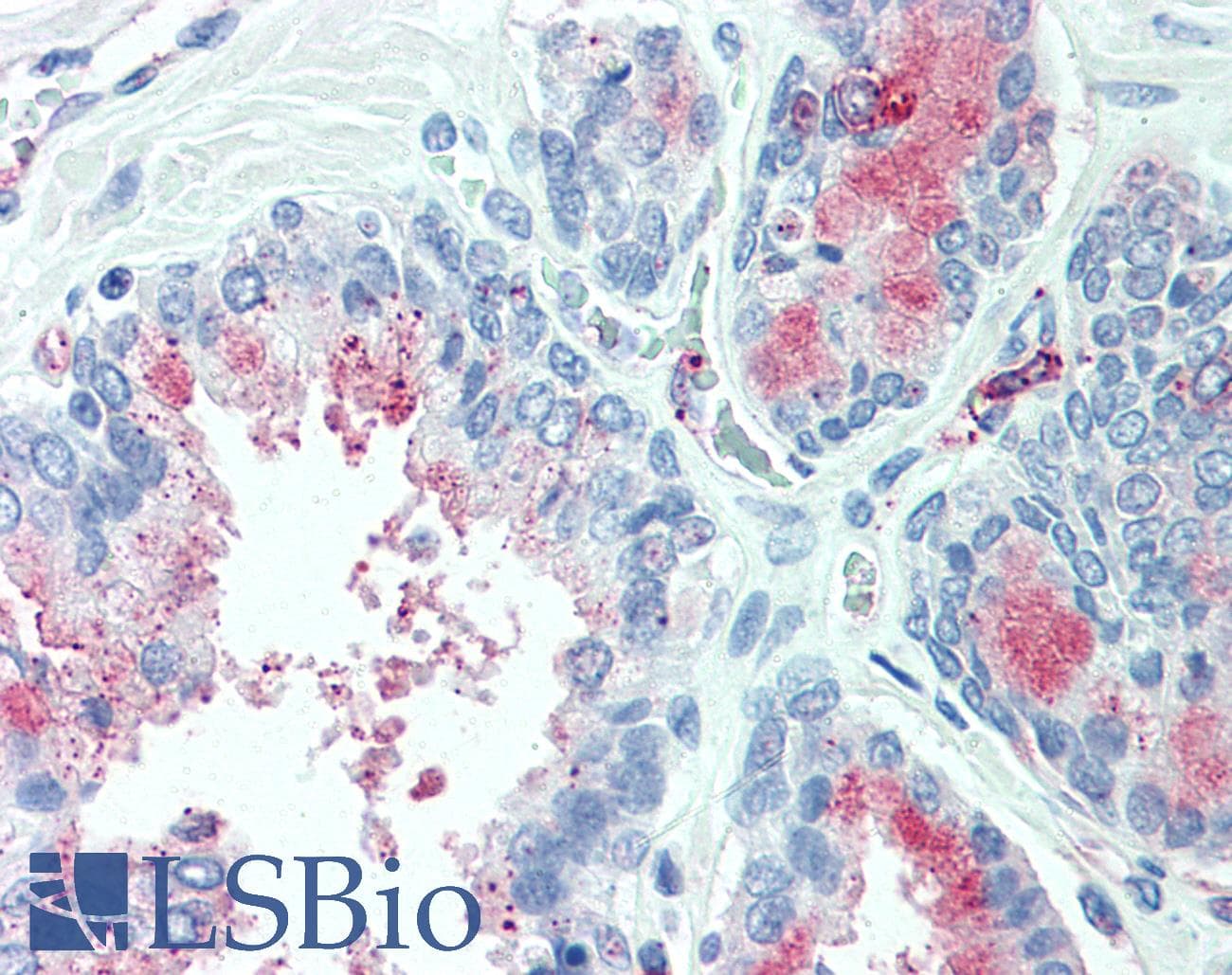 IHC-plus™ Polyclonal Rabbit anti-Human TSPAN13 / TM4SF13 Antibody (Internal, IHC)