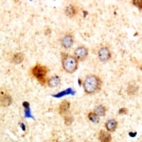 DMTN / Dematin Antibody (C-Terminus)