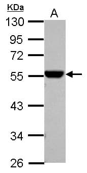 PathPlus™ ALDH1A1 / ALDH1 Antibody