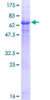 Human NAALADL2 Protein (Recombinant GST)