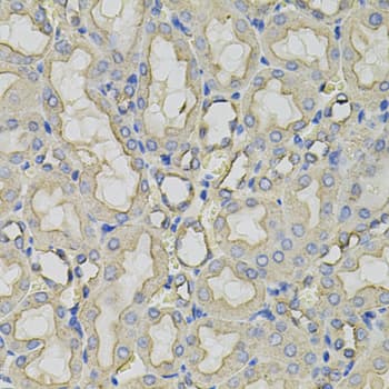 IHC-plus™ CLTC / Clathrin Heavy Chain Antibody