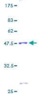 Human ASF1B Protein (Recombinant GST)