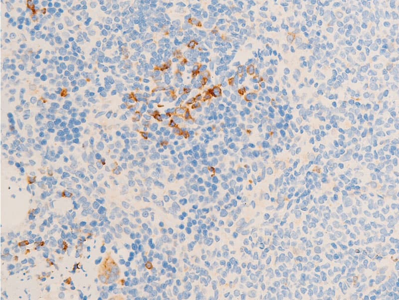 NR3C1/Glucocorticoid Receptor Antibody (phospho-Ser211)