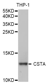 Polyclonal Rabbit anti-Human CSTA / Cystatin A Antibody (IHC, IF, WB)