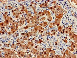Polyclonal Rabbit anti-Human ARG1 / Arginase 1 Antibody (IHC, WB)