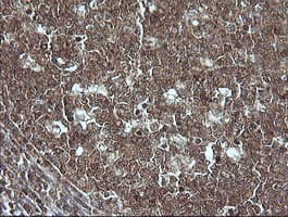 MAP2K1 / MKK1 / MEK1 Antibody (clone OTI4F1)
