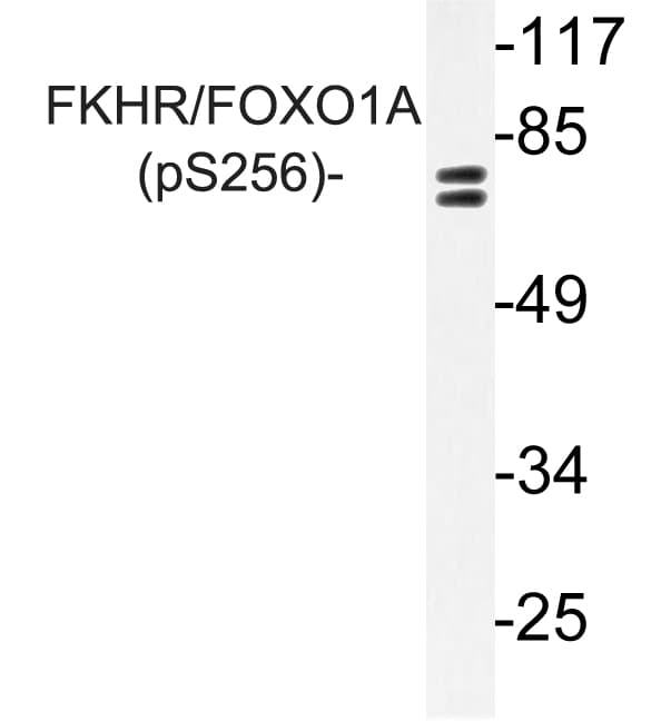 FOXO1 / FKHR Antibody (phospho-Ser256)