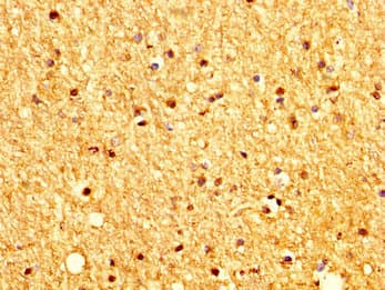 PTCH2 / Patched 2 Antibody