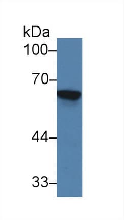 TREH Antibody (aa151-411)