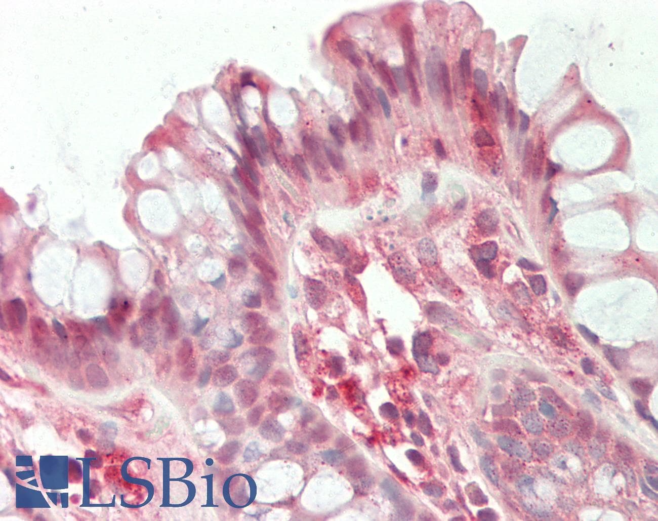 IHC-plus™ Polyclonal Rabbit anti-Human HDAC5 Antibody (aa325-375, IHC, WB)
