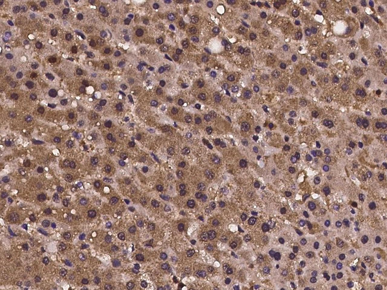 CRISPLD2 Antibody