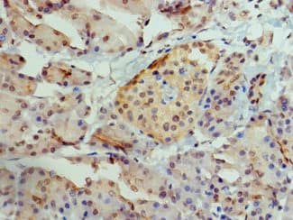Polyclonal Rabbit anti-Human AIRE Antibody (IHC, IF)
