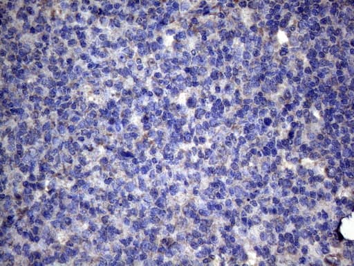 TNFRSF10B / Killer / DR5 Antibody (aa203-411, clone OTI5G5)