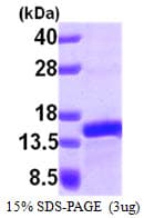 Human PFDN1 Protein (Recombinant His)