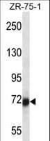 SP100 Antibody (aa199-227)