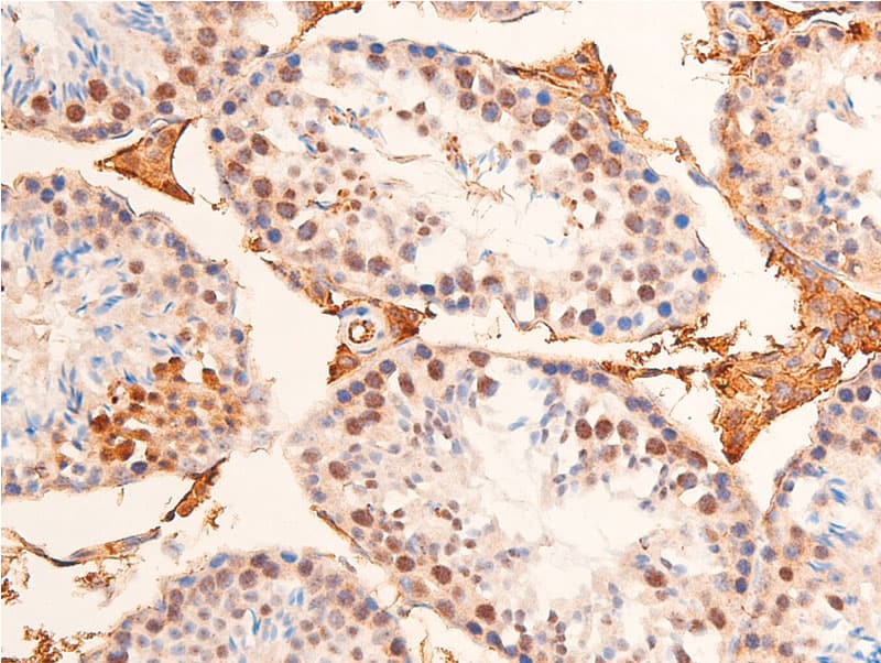 Polyclonal Rabbit anti-Human CHEK1 / CHK1 Antibody (phospho-Ser280, IHC, IF, WB)