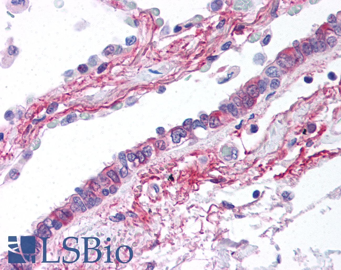 IHC-plus™ HIF3A / HIF3-Alpha Antibody (N-Terminus)