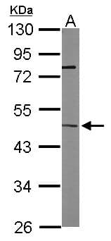 Polyclonal Rabbit anti-Human ITPK1 Antibody (aa171-414, WB)