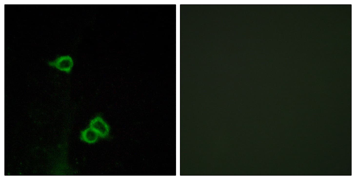 IHC-plus™ Polyclonal Rabbit anti-Human ACKR3 / CXCR7 Antibody (aa311-360, IHC, IF, WB)