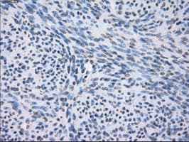FCGR2 / CD32 Antibody (clone OTI16D6)
