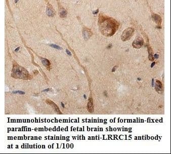 LRRC15 Antibody (aa27-449)