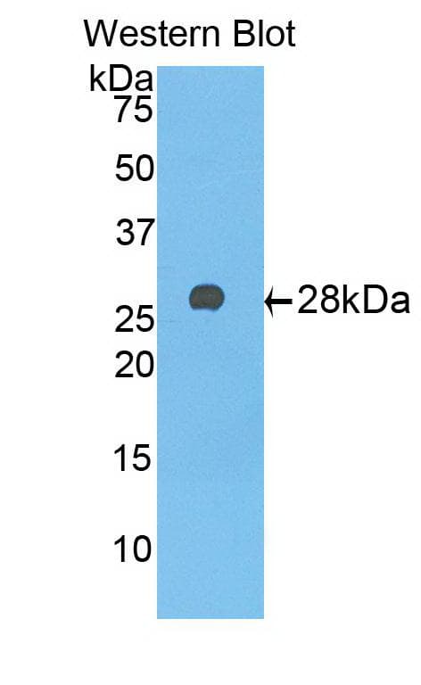 A1BG Antibody (aa220-415, clone A8)