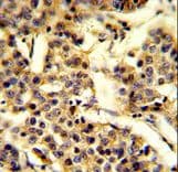 CYP2A13 Antibody (aa446-477)