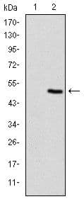TNNI2 Antibody (clone 2F12A11)