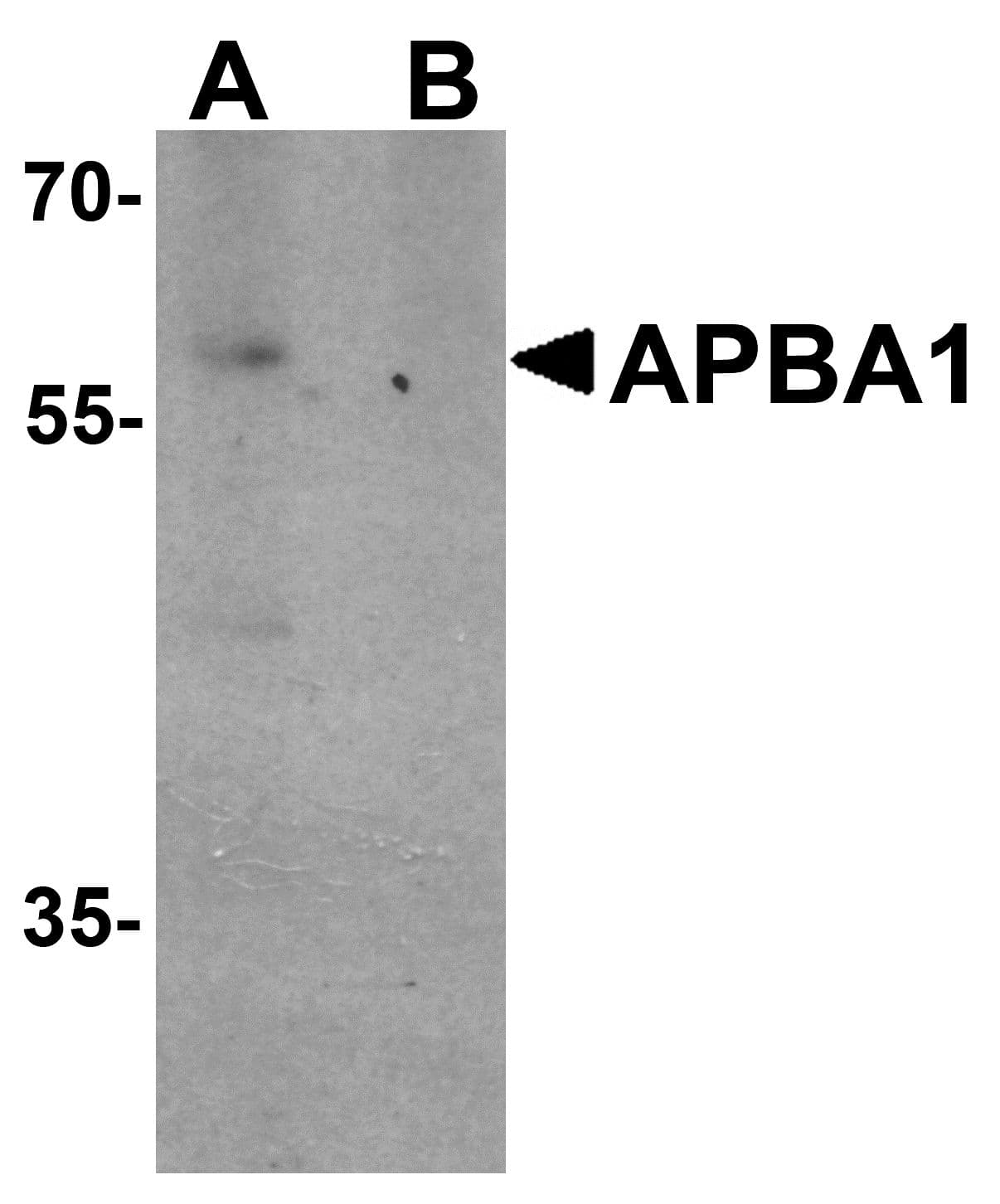 IHC-plus™ APBA1 / MINT1 Antibody