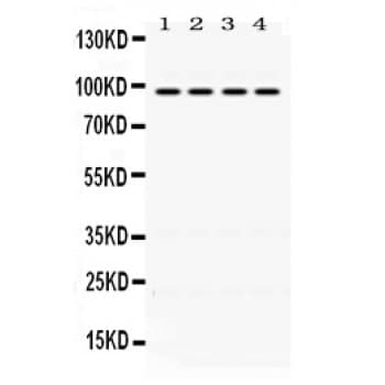 PDCD6IP / ALIX Antibody (aa2-330)