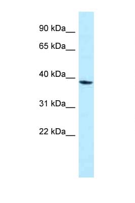 MPPED1 Antibody (aa140-189)