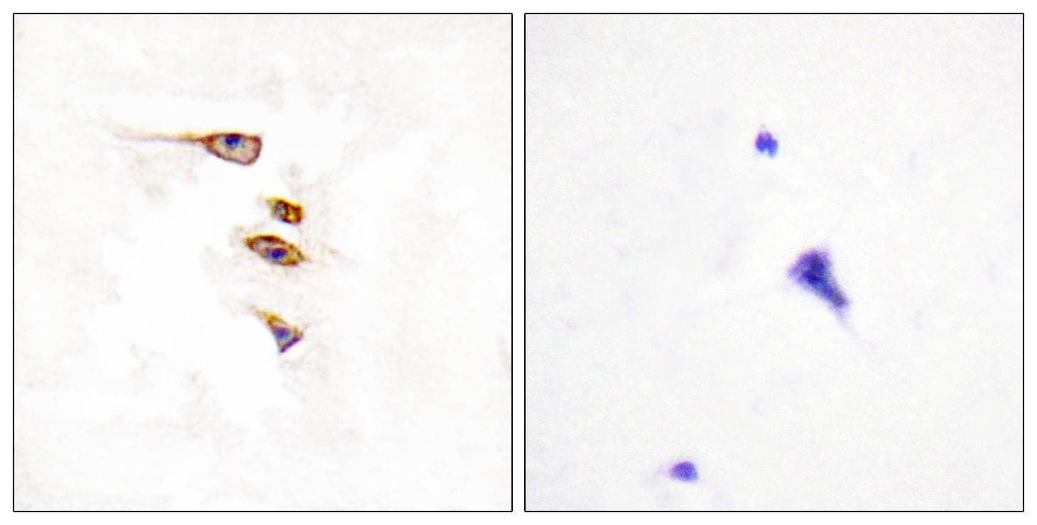 EPHA6 / EPH Receptor A6 Antibody