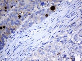 MAGEA3 Antibody (clone 1A9, Carrier-free)
