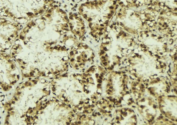 TLE3 Antibody