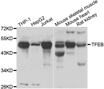 IHC-plus™ TFEB Antibody