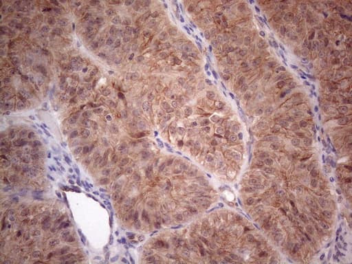 Monoclonal Mouse anti-Human MTF-1 Antibody (clone OTI2F3, aa1-272, IHC, WB)