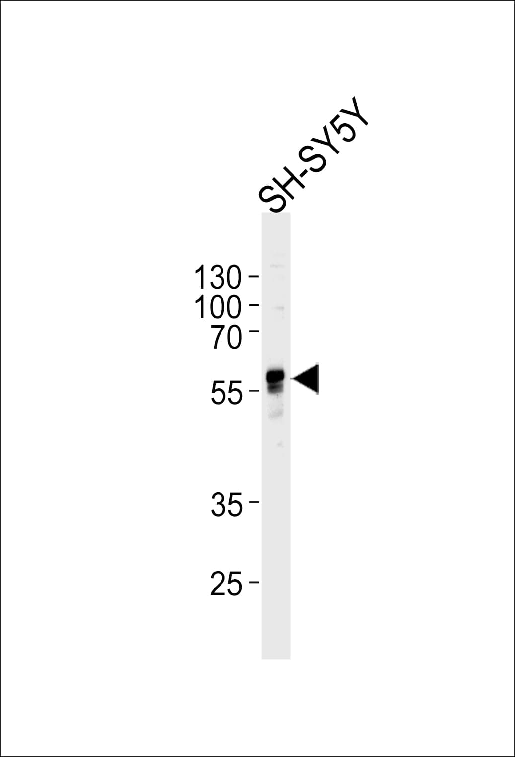 ABHD3 Antibody (aa282-310)