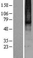 OPRM1 / Mu Opioid Receptor Protein (Over-Expression Lysate Myc-DDK (Flag))