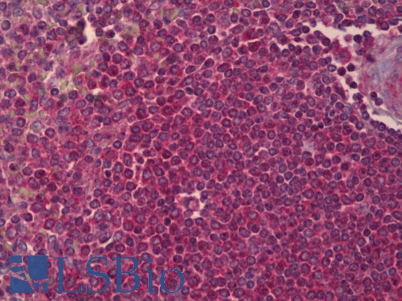 IHC-plus™ PPP2R2B Antibody (aa22-128, clone 1F3)